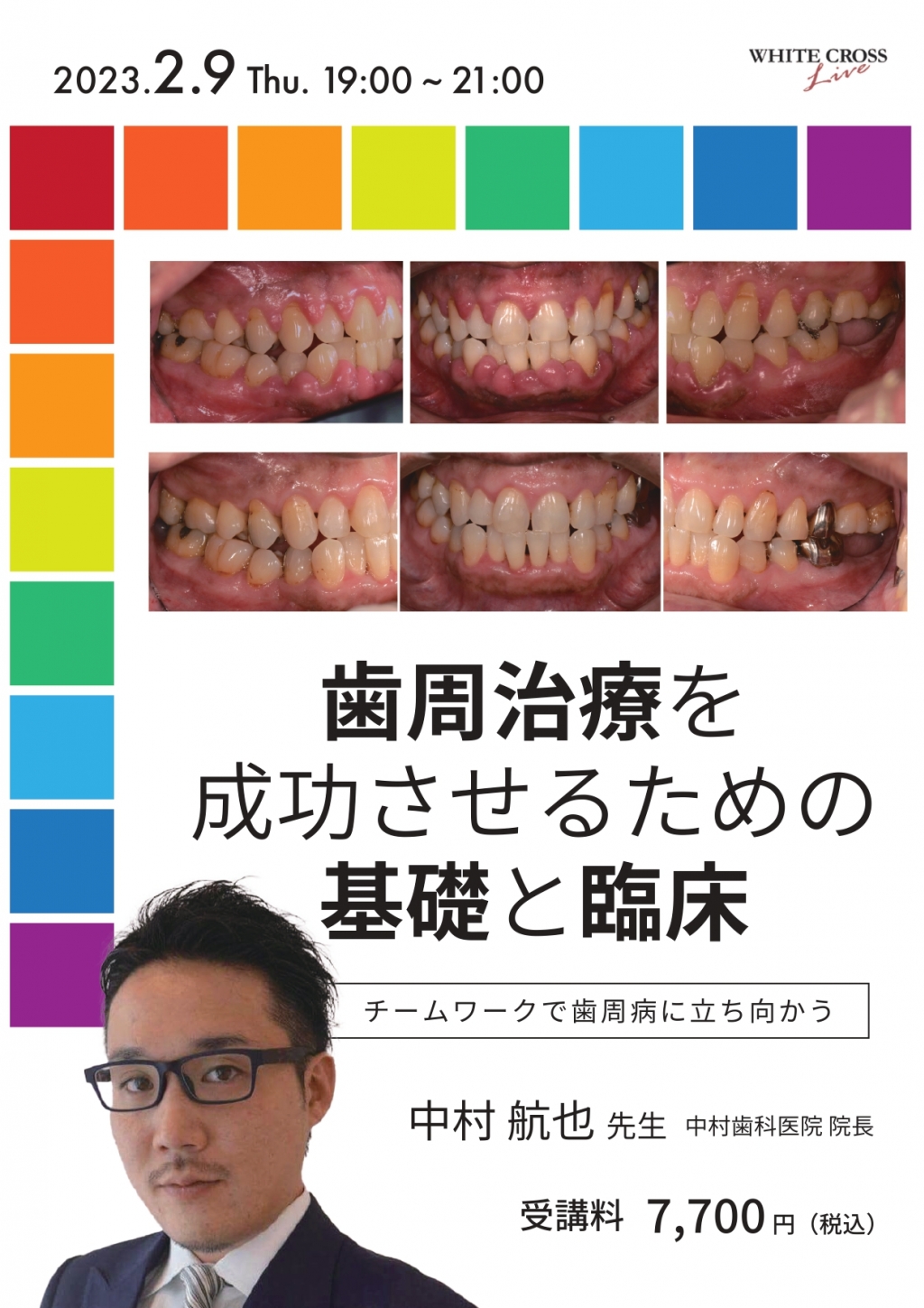 録画配信］歯周治療を成功させるための基礎と臨床 | WHITE CROSS